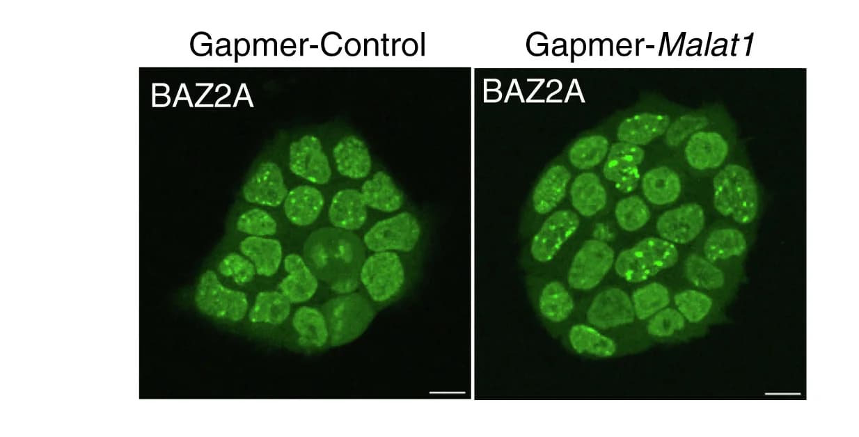 Open access visualization of Microscopy, ESC, mGFP-BAZ2Aend, Gapmer-Control, Gapmer-Malat1