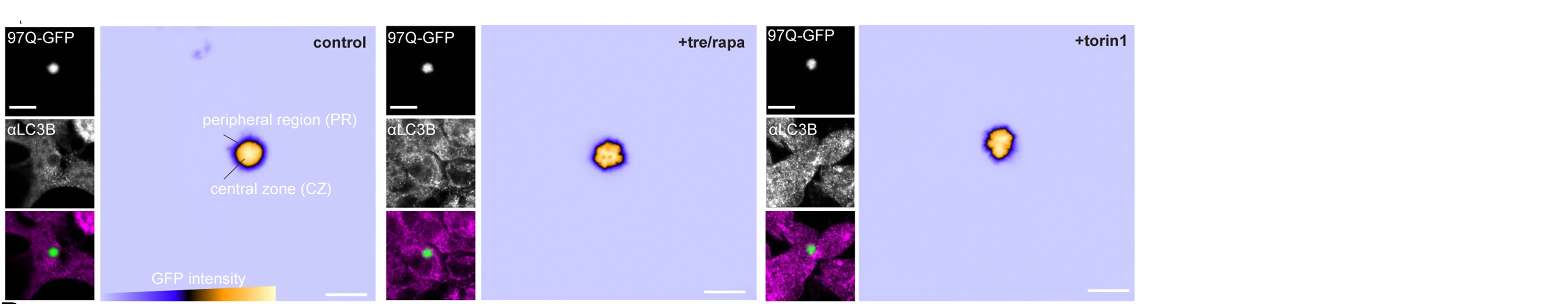 Open access visualization of Microscopy, Confocal Images, Control, LC3A/B Knockout, Treh/Rapa