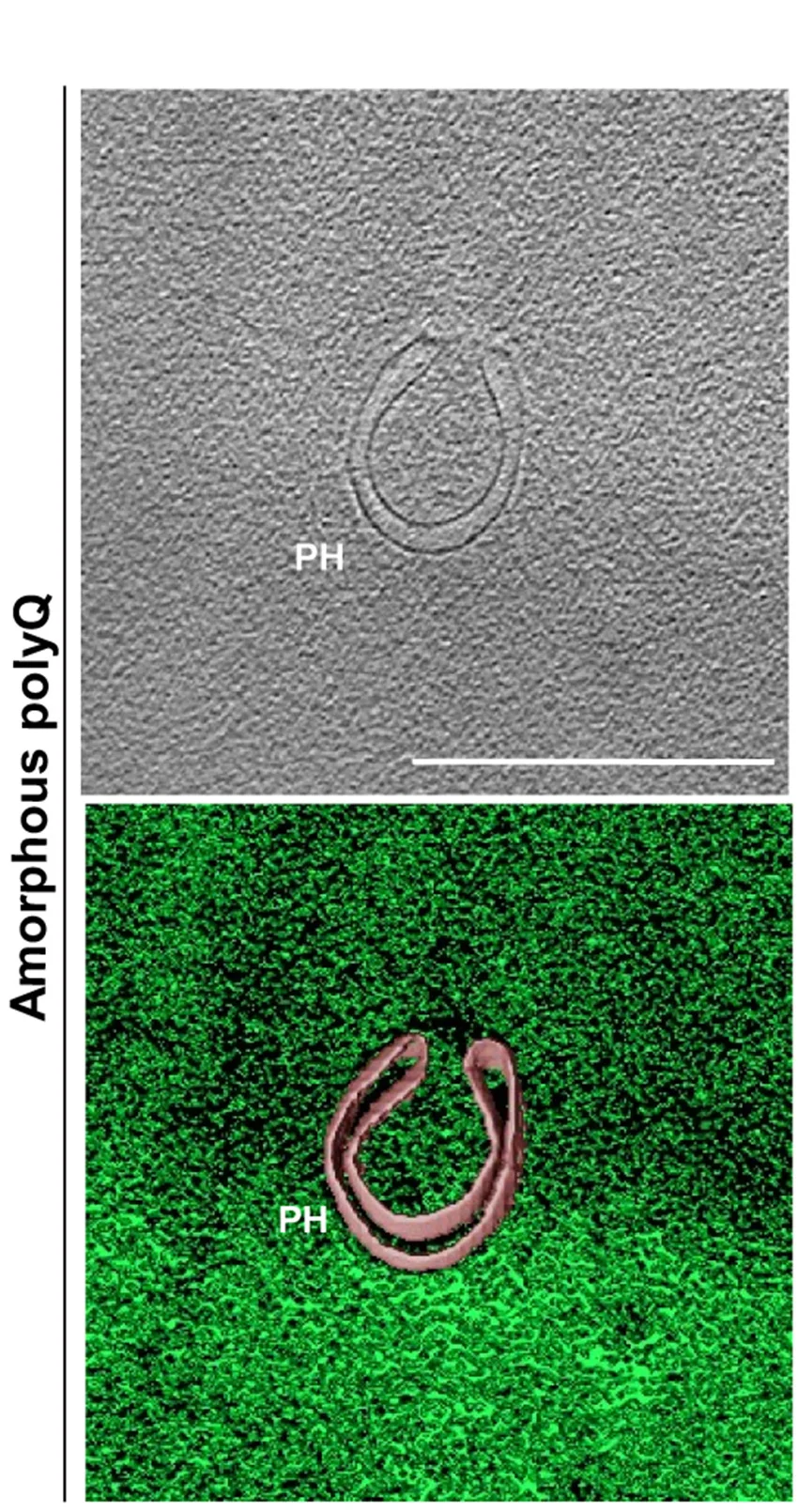Open access visualization of Microscopy, Tomographic Slices, 97Q-GFP, LysoTracker, mCherry-LC3B