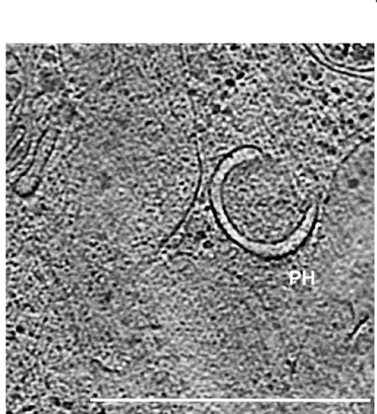 Open access visualization of Microscopy, Tomographic Slices, 97Q-GFP, LysoTracker, mCherry-LC3B