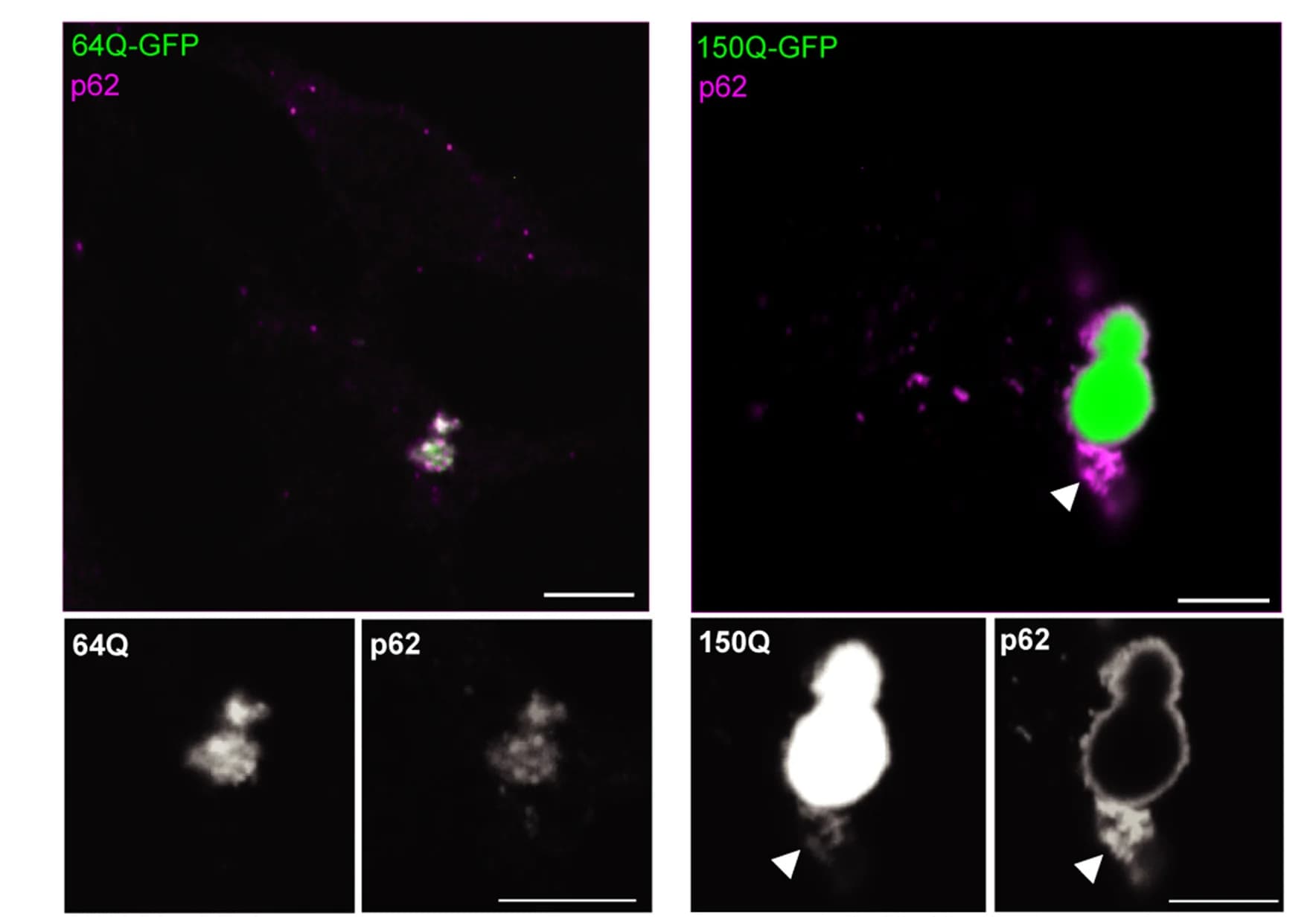 Open access visualization of Microscopy, Confocal Images, 64Q-GFP, 150Q-GFP, Antibody
