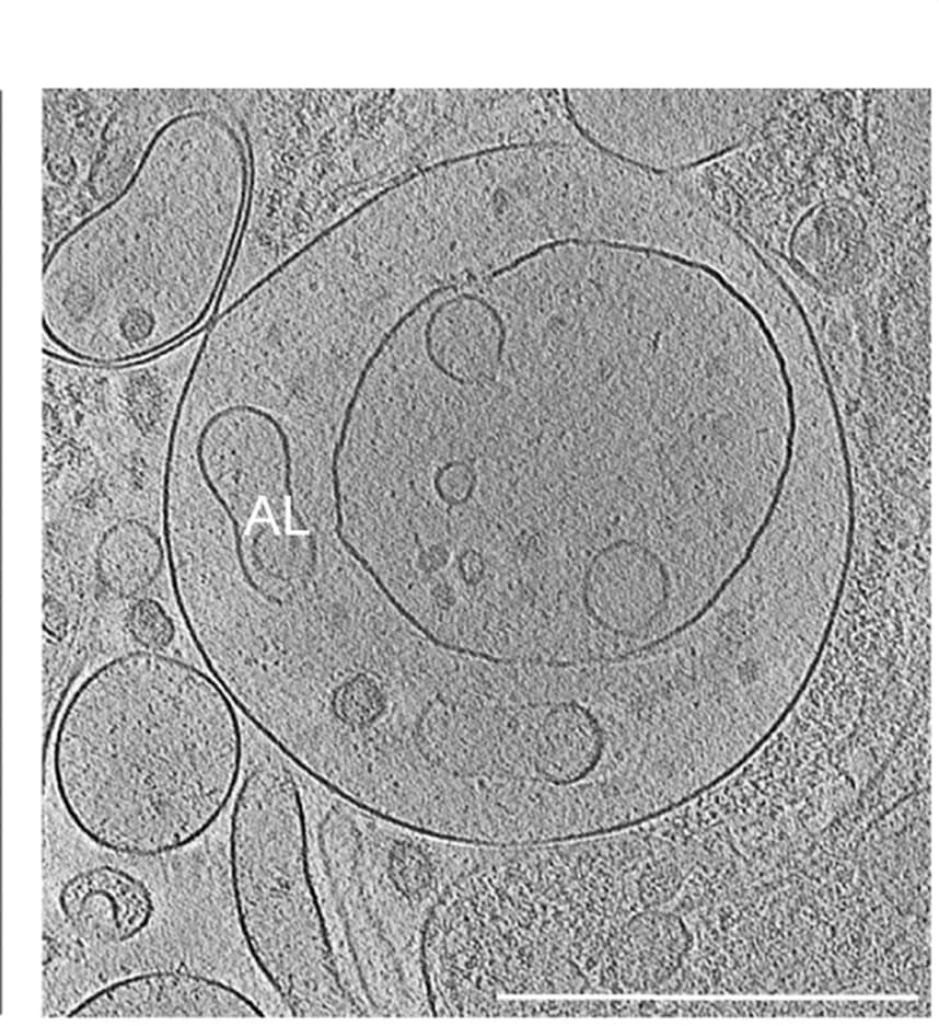 Open access visualization of Microscopy, Autolysosomes, Amorphous Content