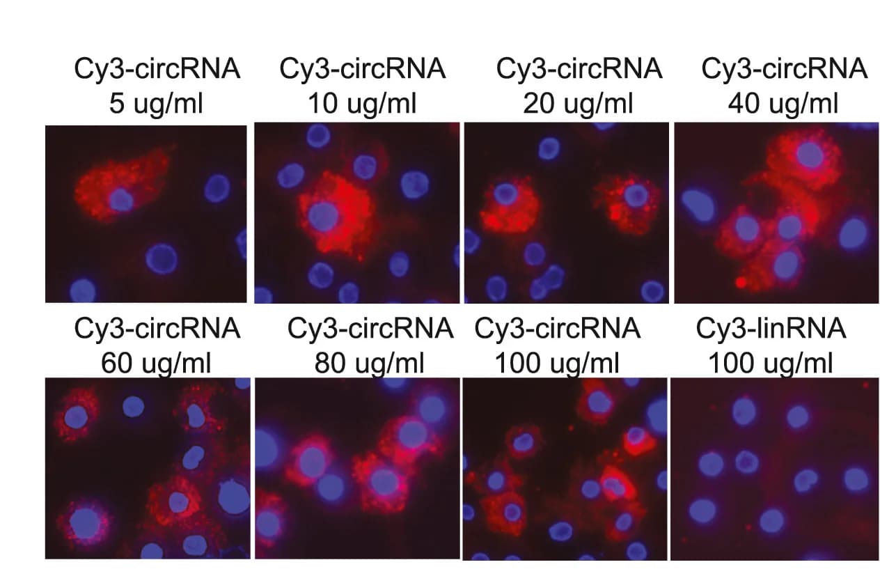 Open access visualization of Microscopy, Fluorescence Microscopy, circRNA, linRNA, Human Macrophages