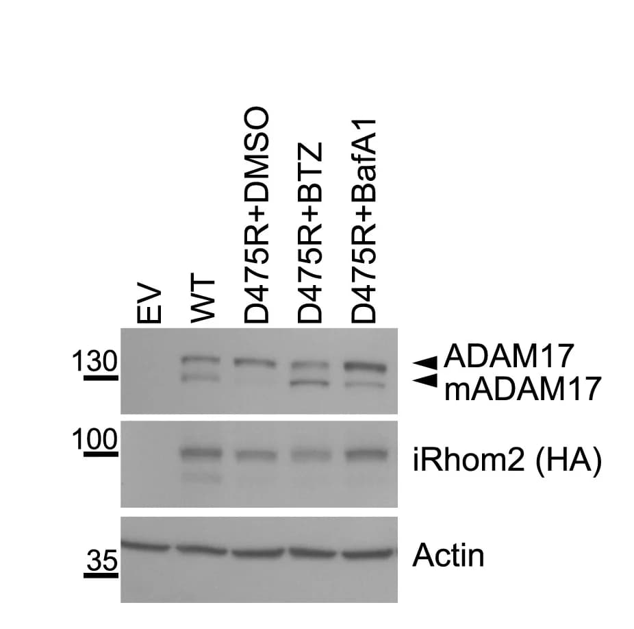 Open access visualization of Gel, Western Blot, iRhom1/2 DKO HEK293 Cells, Transfection, iRhom2 Mutants
