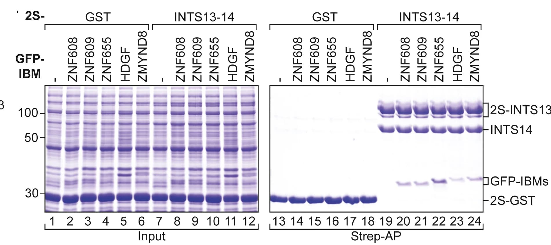 Open access visualization of Gel, Coomassie Staining, SDS-PAGE, GFP-tagged IBMs, E. Coli