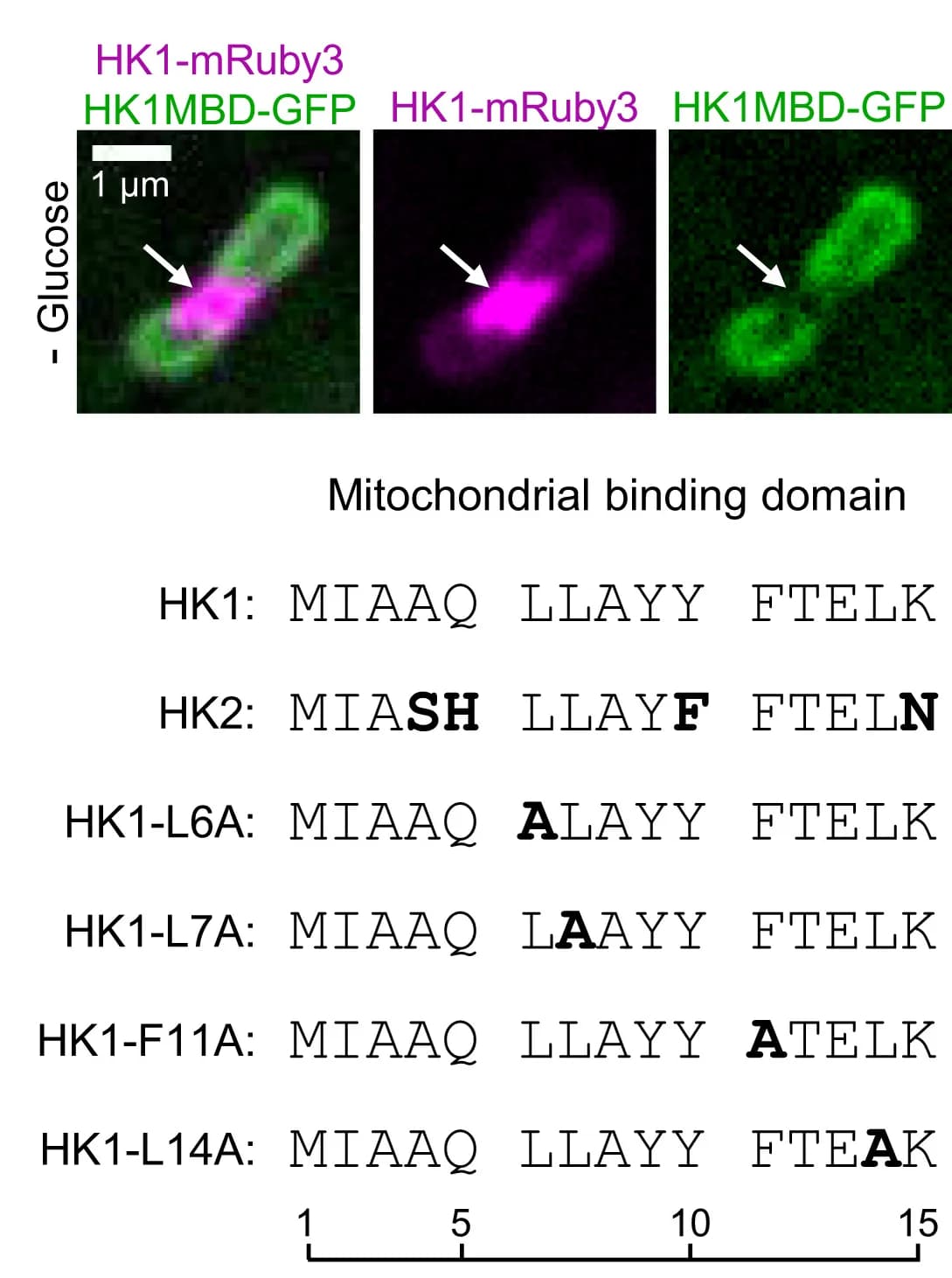 Open access visualization of Microscopy, Table Image, HK1MBD-GFP, HK1-Rings, Confocal Images