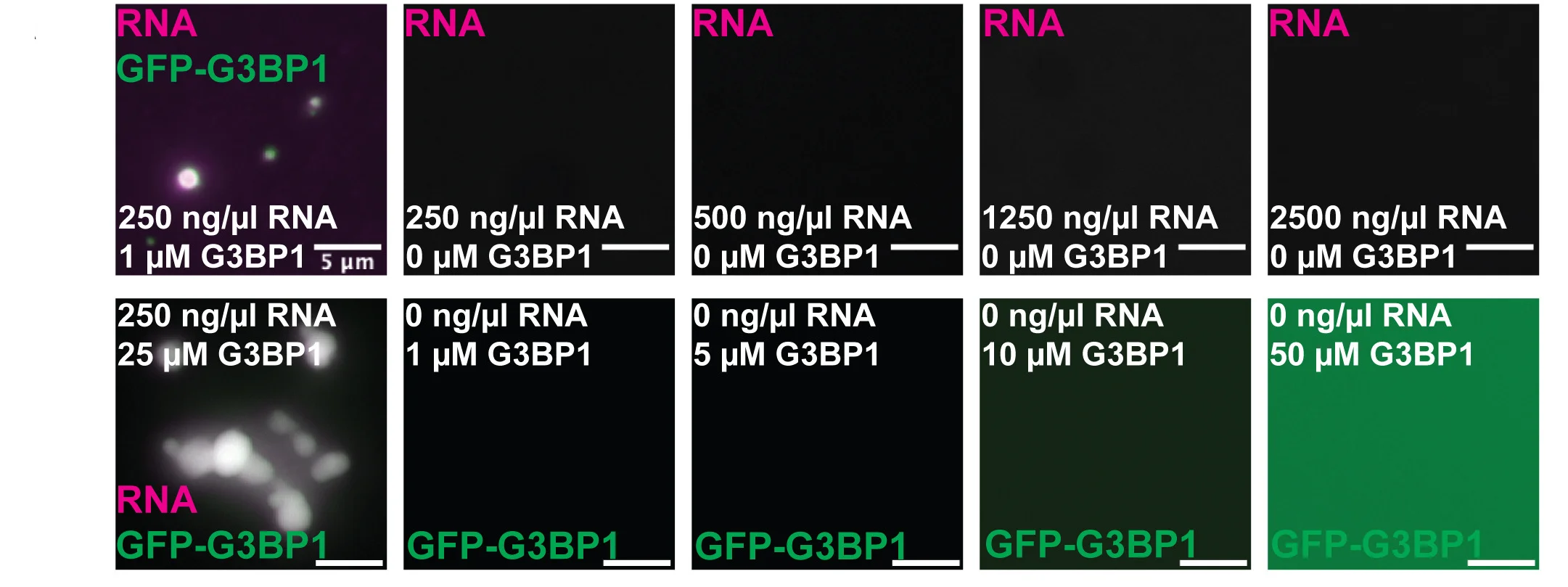 Open access visualization of Microscopy, GFP-G3BP1, RNA, Condensation Buffer, U2OS RNA