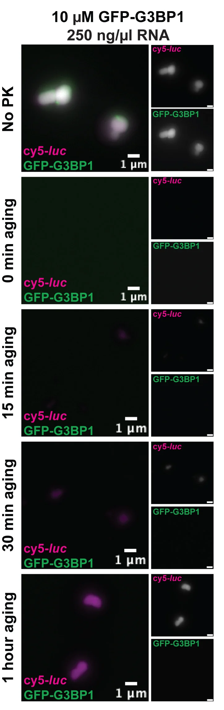Open access visualization of Microscopy, G3BP1, RNA, Co-condensates, GFP-G3BP1