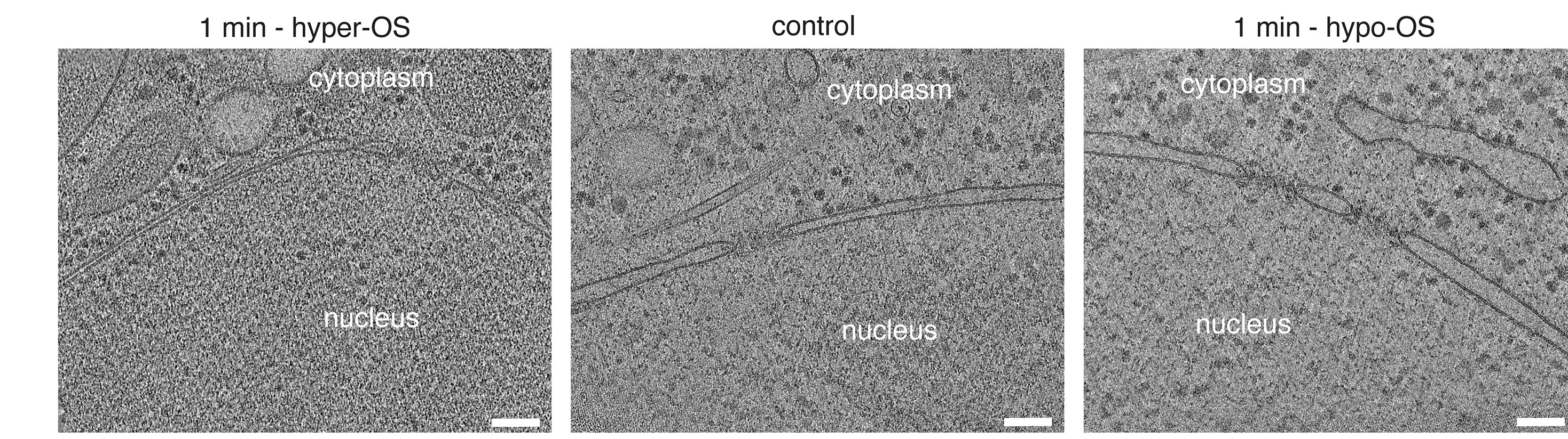 Open access visualization of Microscopy, Cryo-tomograms, Cells, Control Cells, Hyper-OS