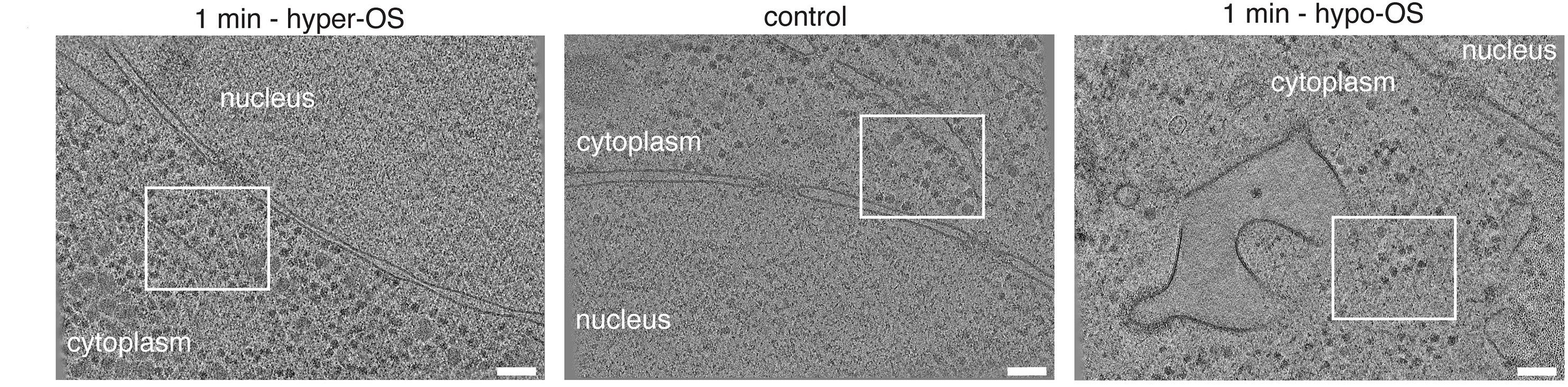 Open access visualization of Microscopy, Cryo-Tomogram, Cell, Hyper-OS, Hypo-OS