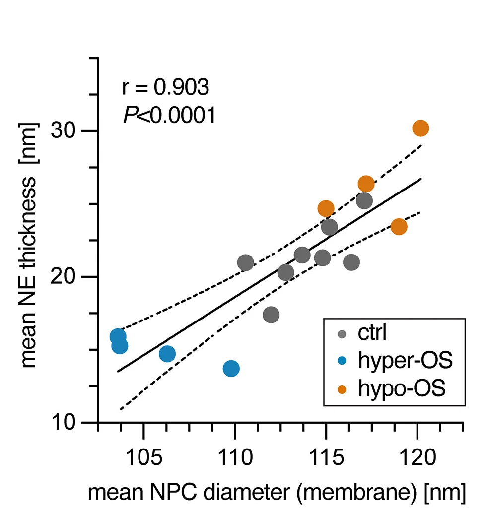 Open access visualization of Scatter Plot, Regression Plot, NE, Thickness, NPC