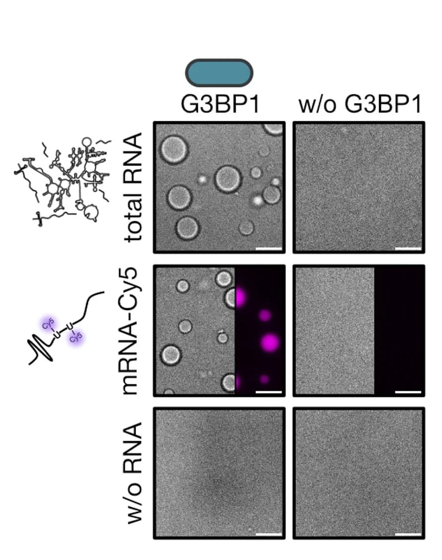 Open access visualization of Microscopy, Illustration, G3BP1 Condensates, Total RNA, mRNA-Cy5 Condensates