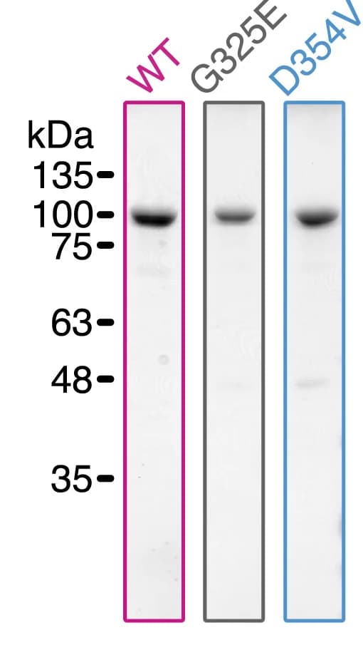Open access visualization of Gel, Coomassie Brilliant Blue, SDS-PAGE, Purified DDX3X Variants