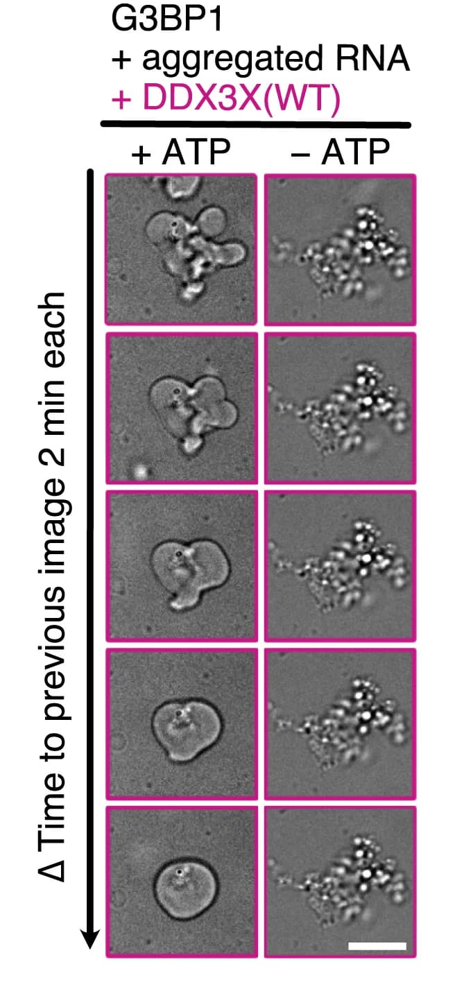 Open access visualization of Microscopy, Aggregated Condensates, DDX3X(WT), Reaction Buffer, ATP/MgCl2