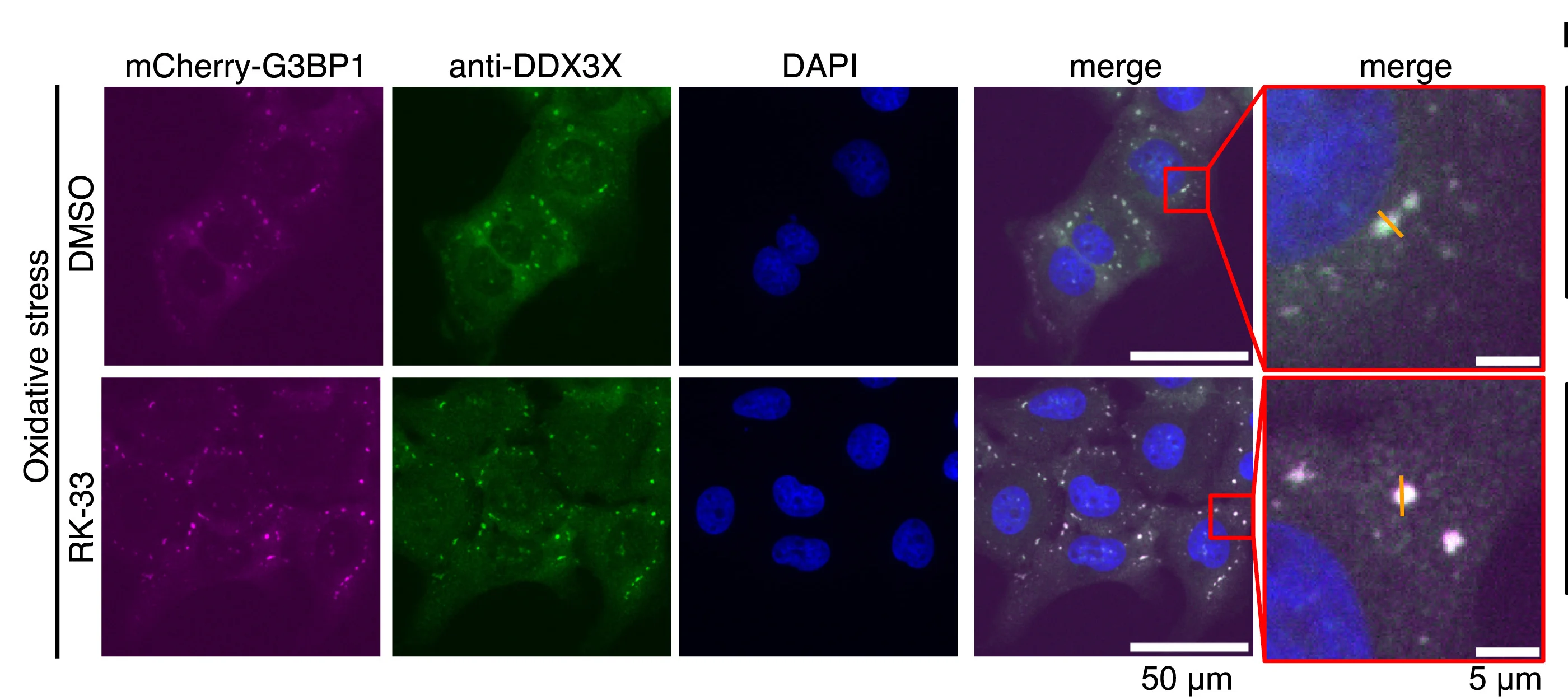 Open access visualization of Microscopy, Cells, Immunofluorescence Microscopy, Na3AsO4, RK-33