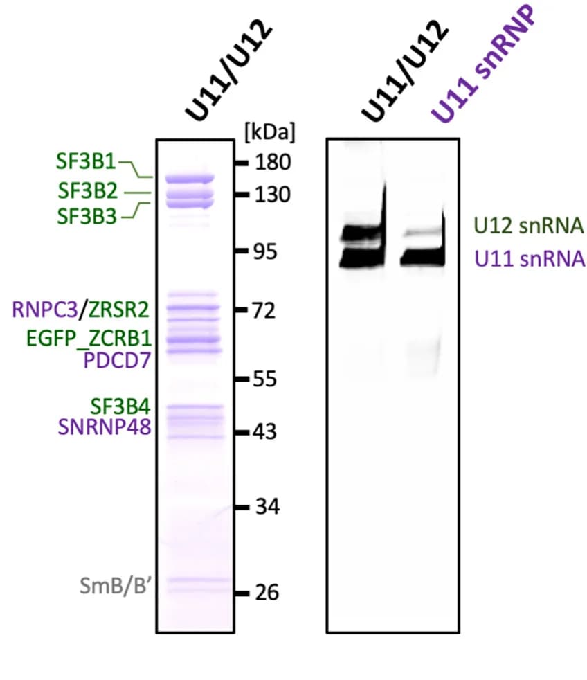 Open access visualization of Gel, SDS-PAGE, Urea-PAGE, Purified Complexes, Gel Electrophoresis