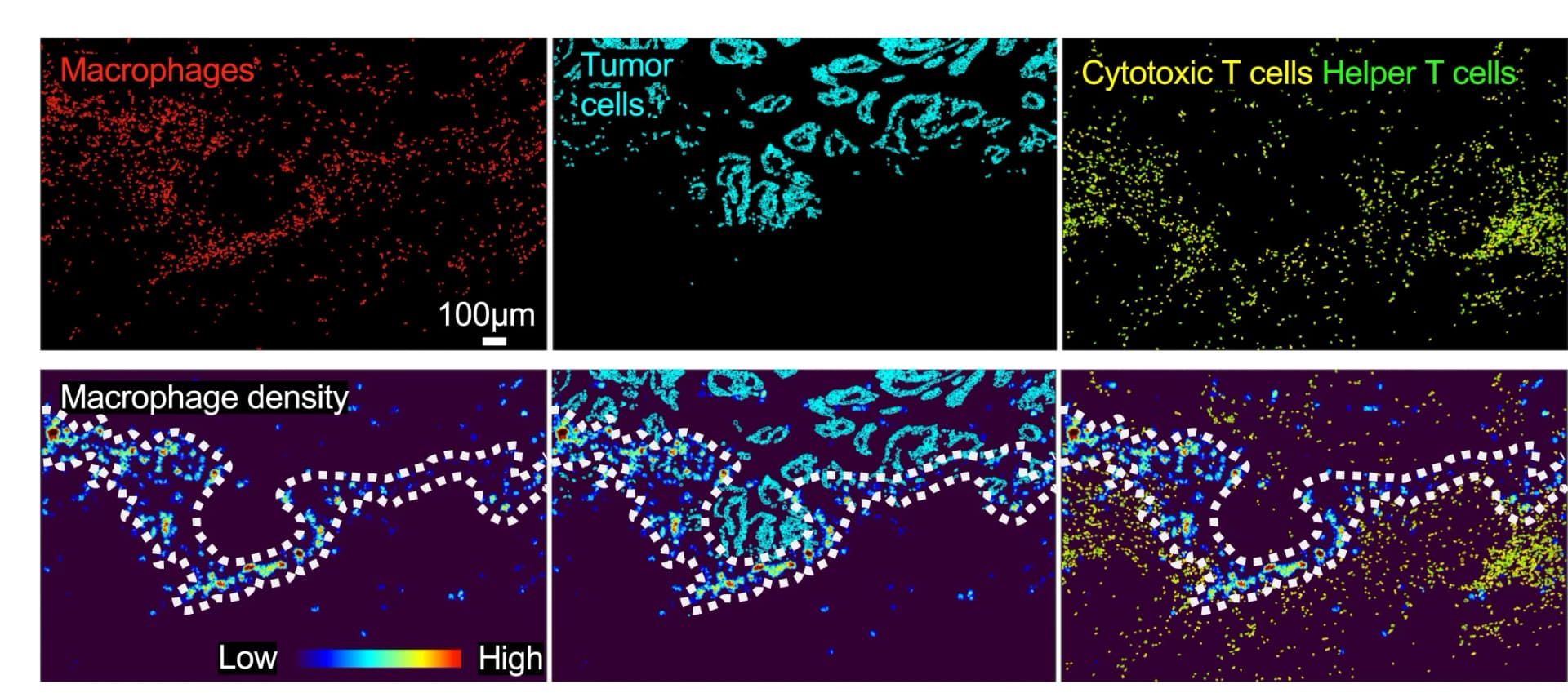 Open access visualization of Microscopy, Heatmap, Scatter Plot, Macrophage, Tumor Cells