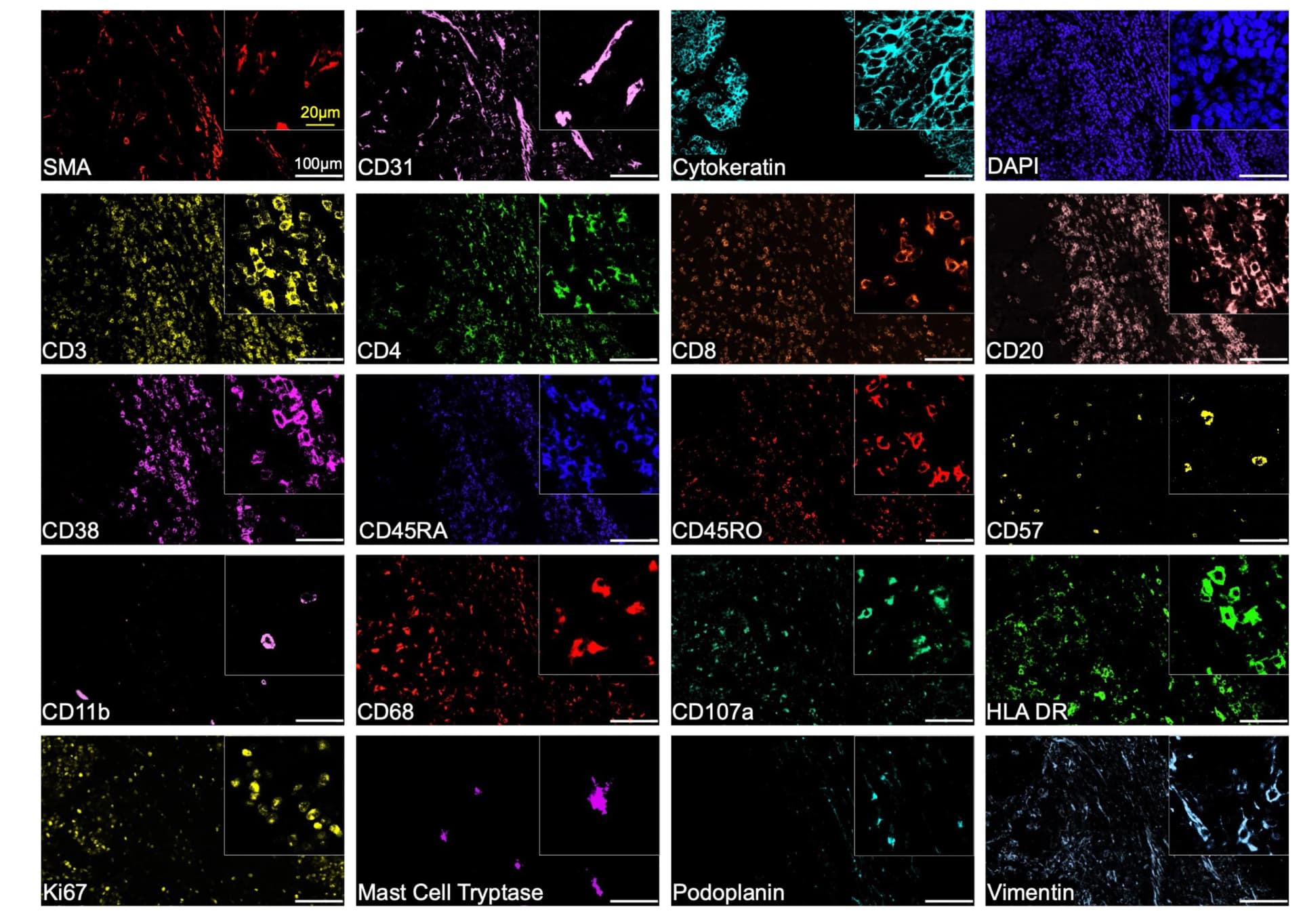 Open access visualization of Microscopy, Tonsil Cancer, Tissue Section, Multiplexed Staining