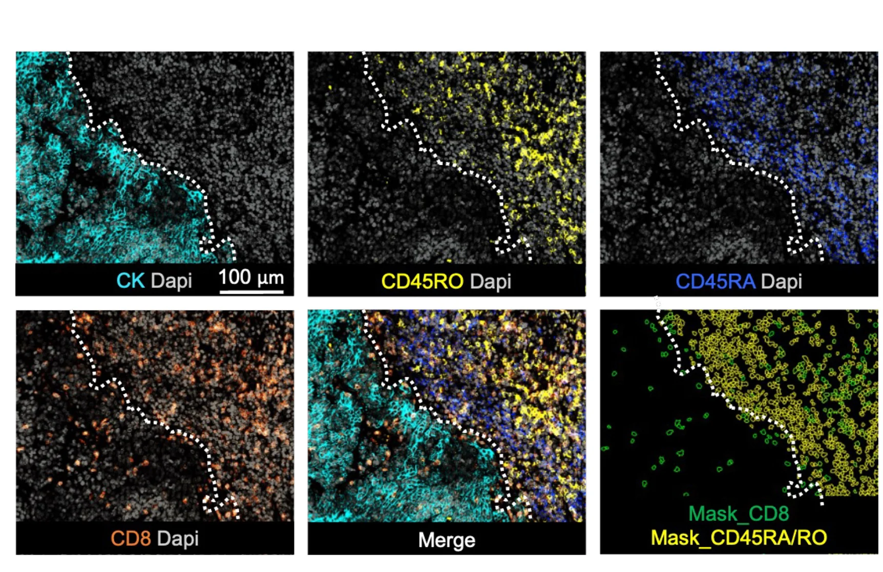 Open access visualization of Microscopy, Representative Images, CD3, CD8, CTLs