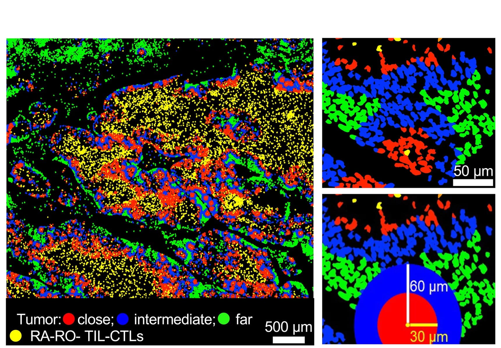Open access visualization of Microscopy, Representative Image, Tumor Cells, RA RO TIL-CTLs, Proximity