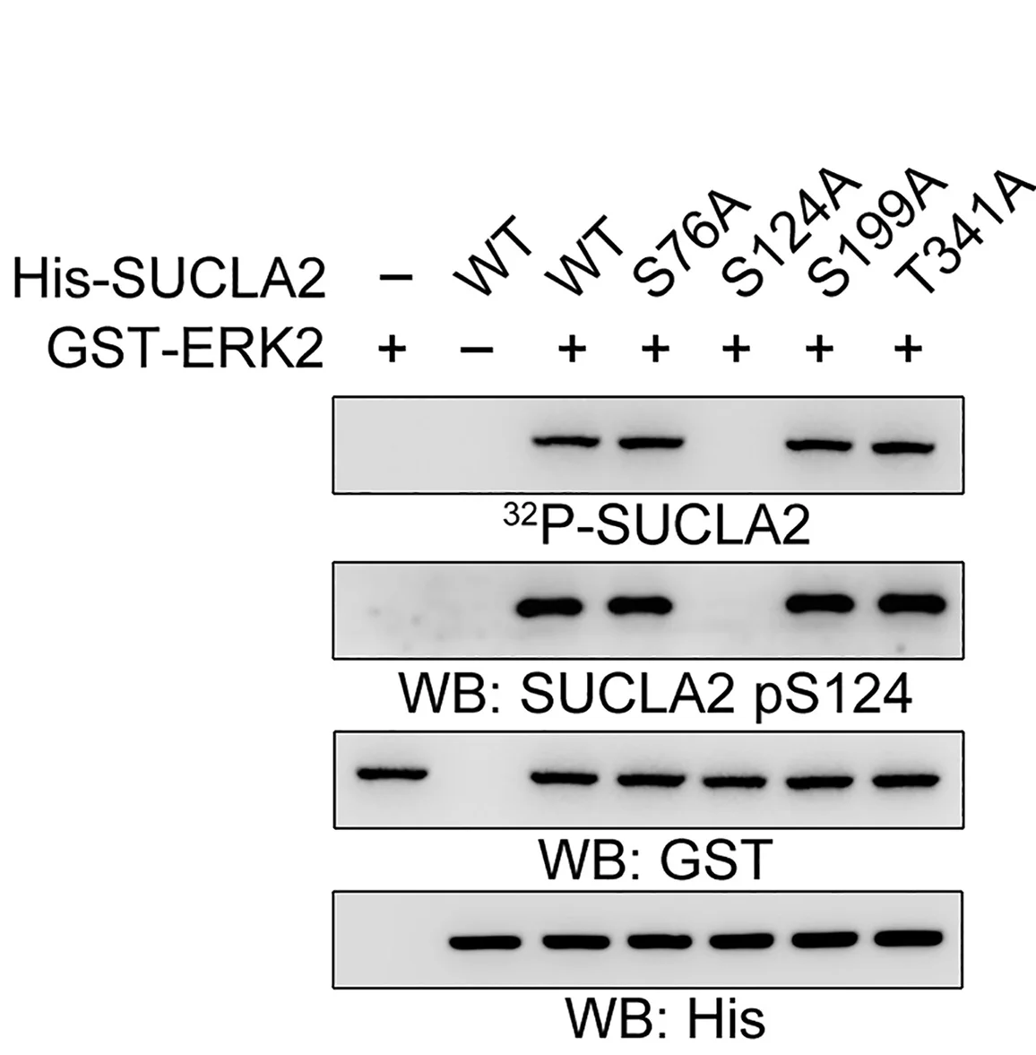Open access visualization of Gel, In Vitro Kinase Assays, GST-ERK2, His-SUCLA2, His-SUCLA2 Mutants