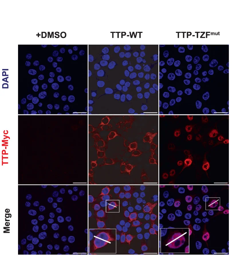 Open access visualization of Microscopy, TTP-WT, TTP-TZFmut, HEK-293 Cells, Myc-tagged