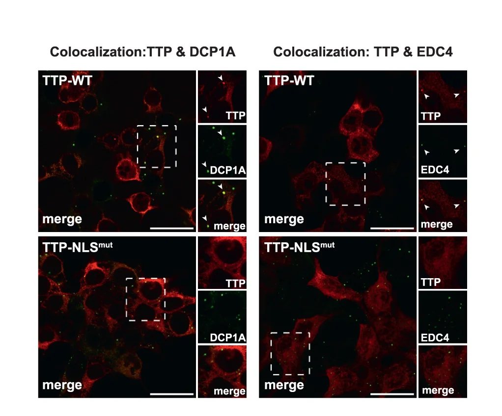 Open access visualization of Microscopy, Colocalization, TTP-WT, TTP-NLSmut, DCP1A