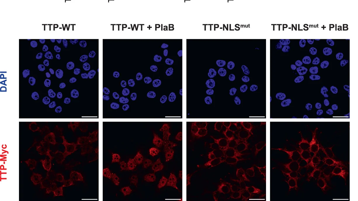Open access visualization of Microscopy, Subcellular Localization, TTP-WT, TTP-NLSmut, PlaB