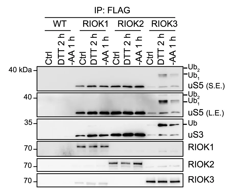 Open access visualization of Gel, Immunoblots, Immunoprecipitation, RIOK1, RIOK2