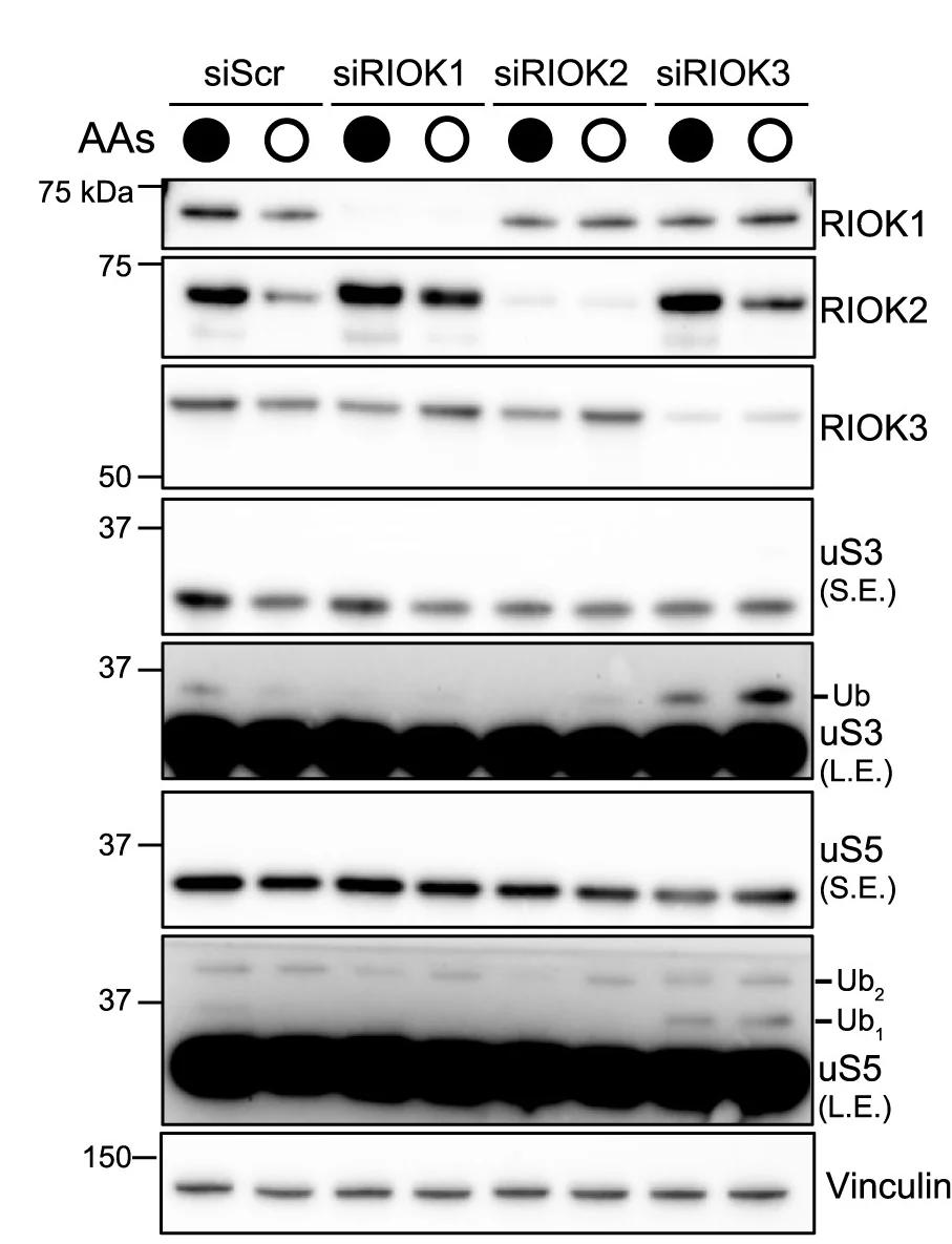 Open access visualization of Gel, Immunoblots, HEK293T Cells, Amino Acids, Knockdown