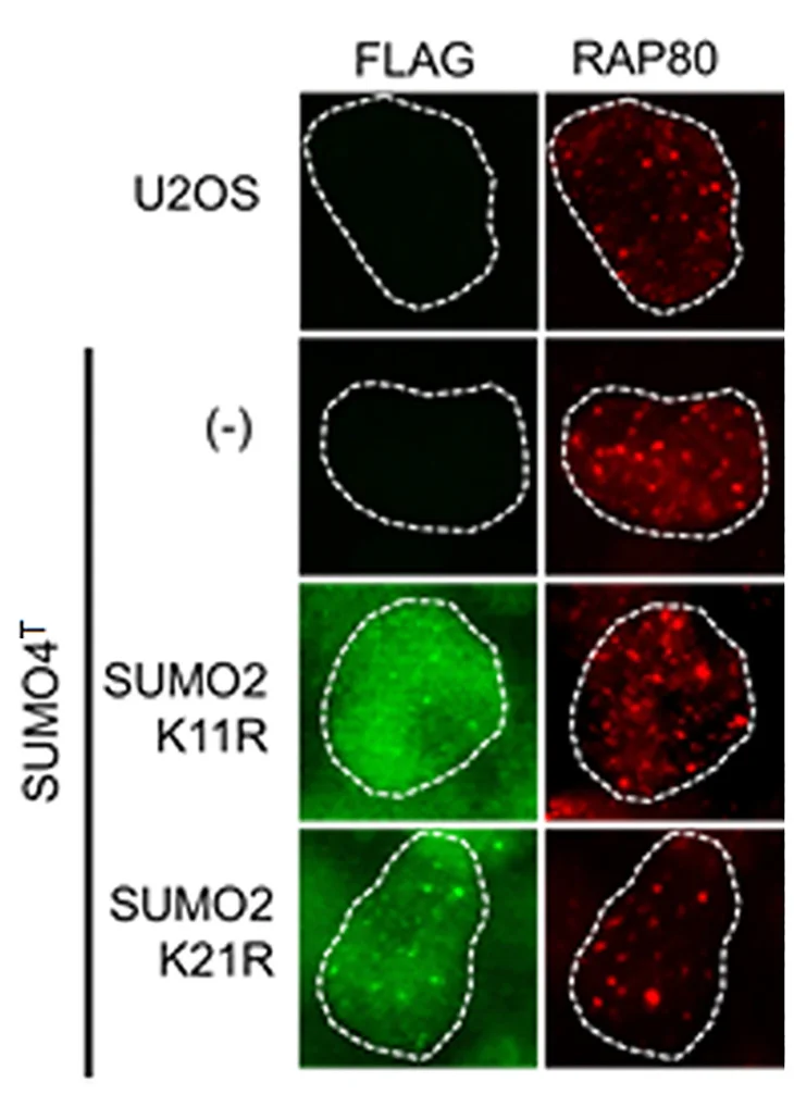 Open access visualization of Microscopy, RAP80 Foci, SUMO4Tcl1.11 U2OS, FLAG-SUMO2K11R, FLAG-SUMO2K21R