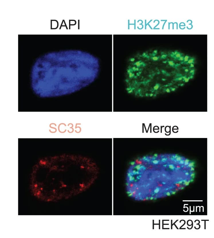Open access visualization of Microscopy, Immunofluorescence, HEK293T Nuclei, DAPI, H3K27me3