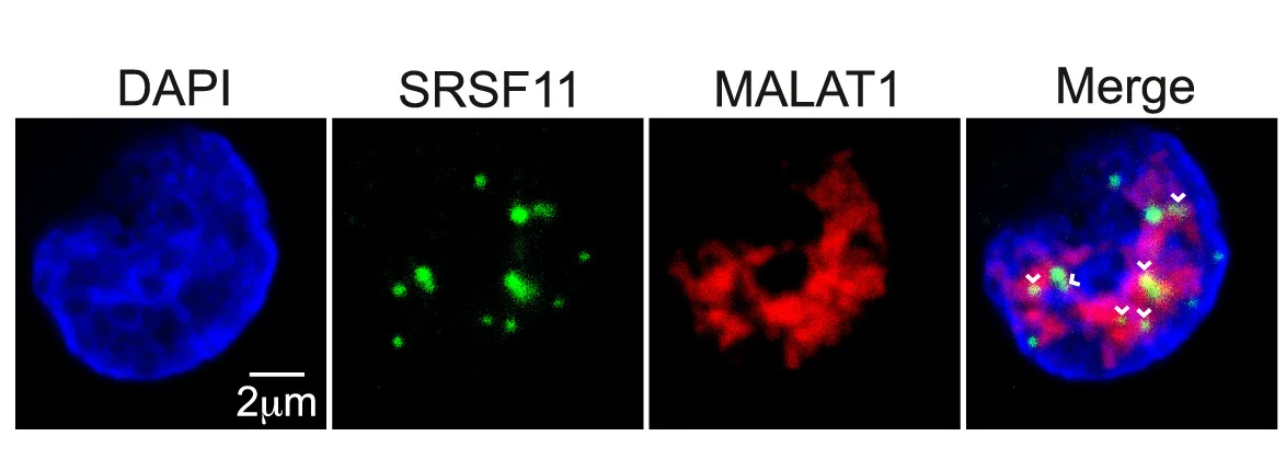 Open access visualization of Microscopy, RNA-FISH, MALAT1, SRSF11 Intron, K562 Cells