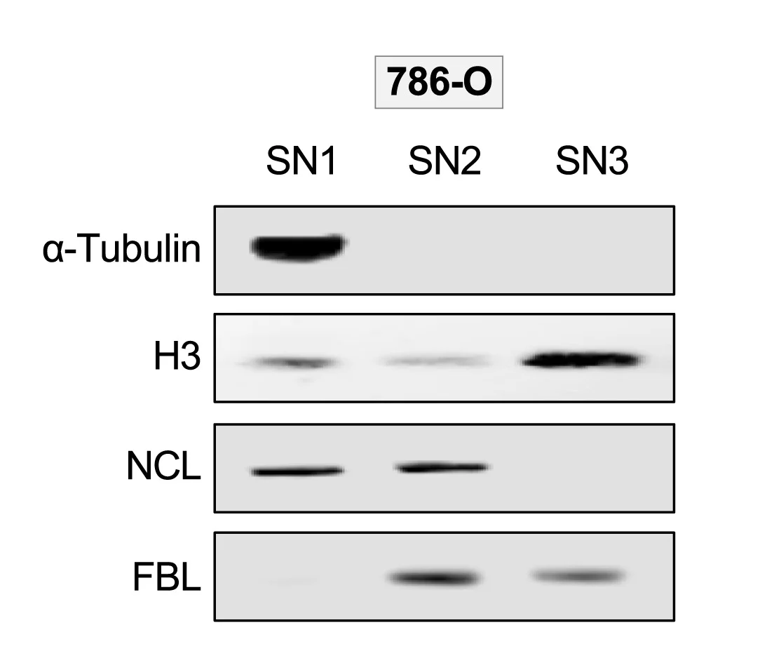 Open access visualization of Gel, Western Blot, Control Proteins, Nucleolar Fractions
