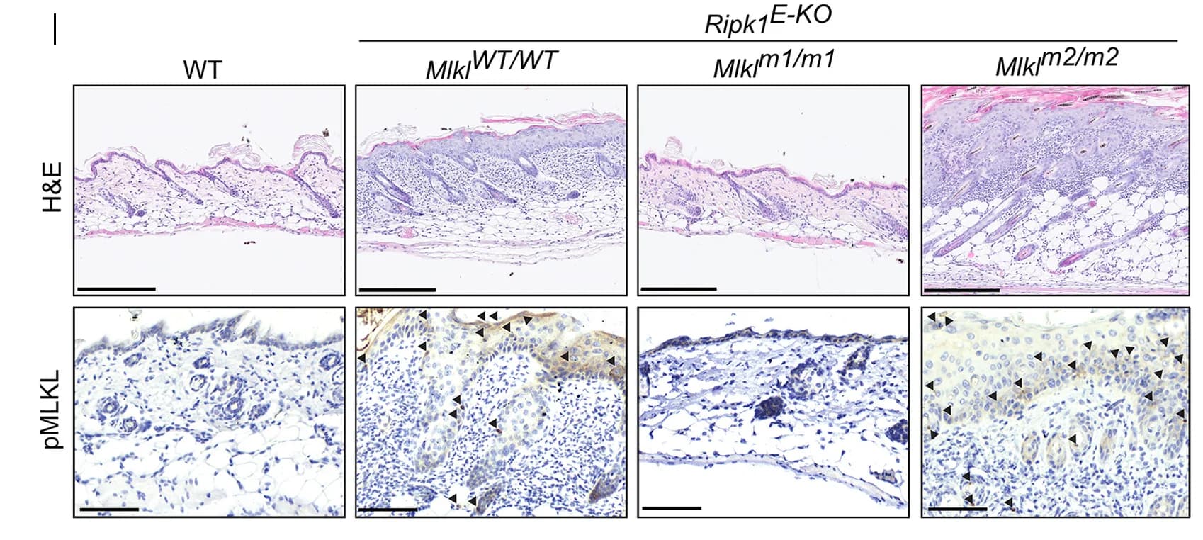 Open access visualization of Microscopy, Haemotoxylin and Eosin Staining, H&E Staining, pMLKL Staining, Images