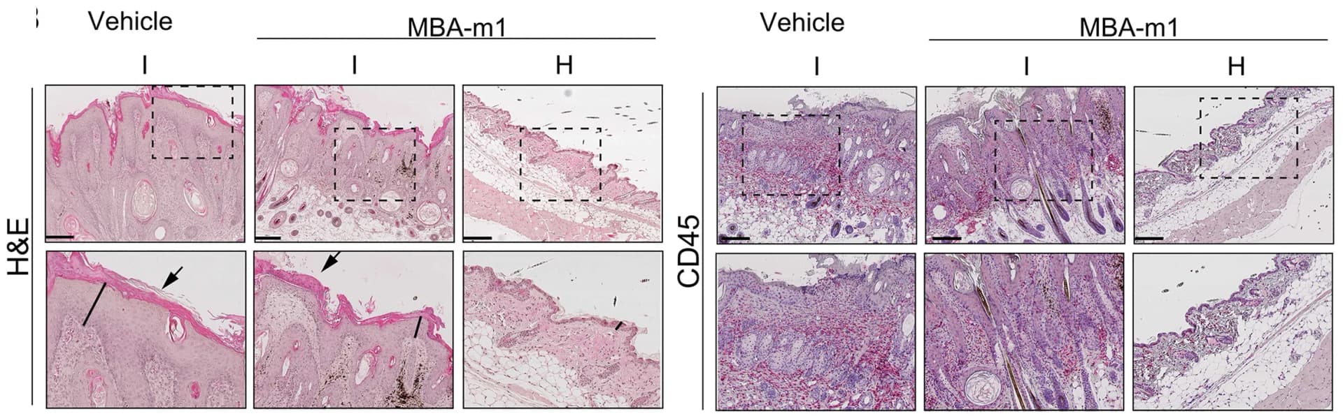 Open access visualization of Microscopy, Epidermal Layer, Hyperkeratosis, H&E Staining, Immunohistochemistry