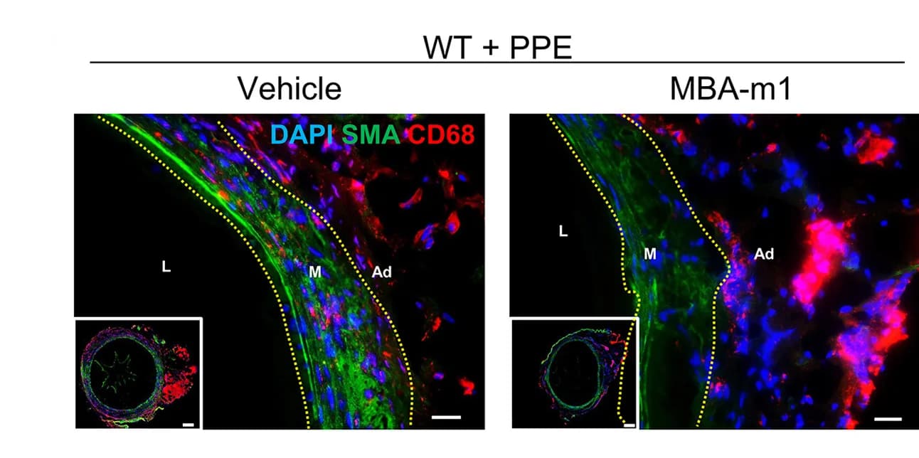 Open access visualization of Microscopy, Confocal Images, Smooth Muscle Cell Marker, SMA, CD68