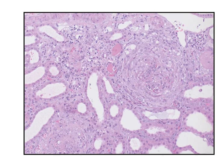 Open access visualization of Microscopy, Renal Biopsy, Hematoxylin and Eosin Stain