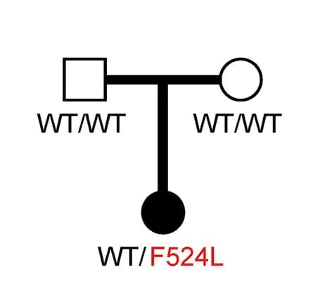 Open access visualization of Pathway, Pedigree, OAS2 F524L Mutation