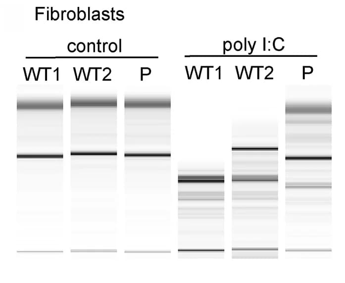 Open access visualization of Gel, RNA Analysis, RNA Pico-Chip, Wild-Type Fibroblasts, Patient-Derived Fibroblasts