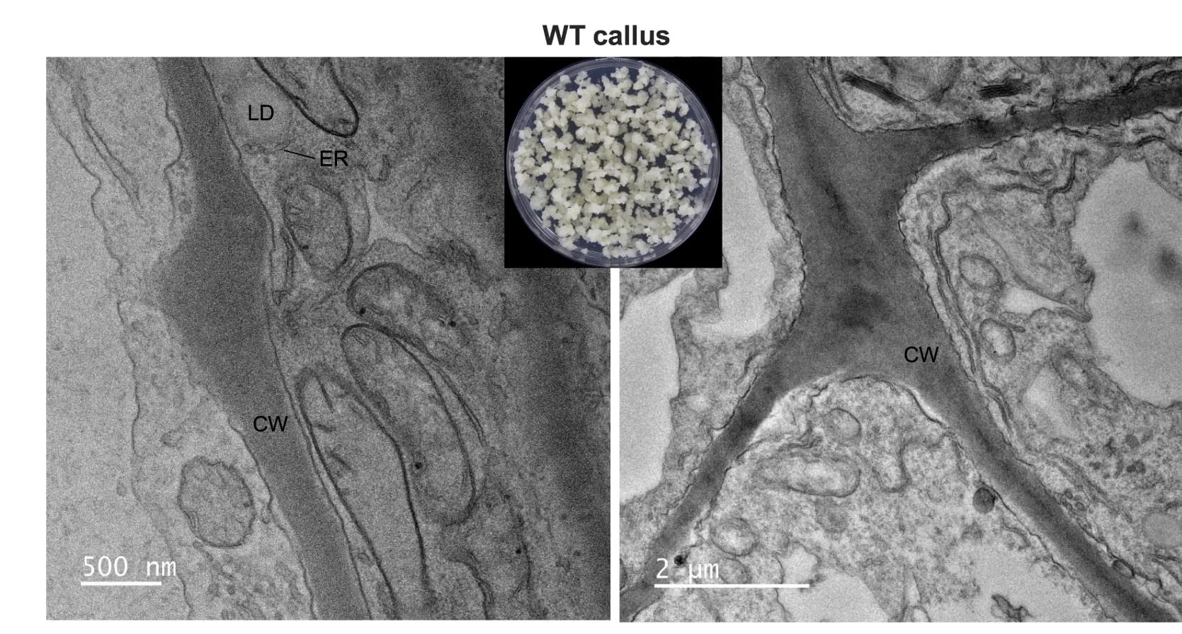 Open access visualization of Microscopy, Photo, Transmission Electron Microscopy, CLDs, tHMGR/AL-1/-2/-3 Transgenic Callus