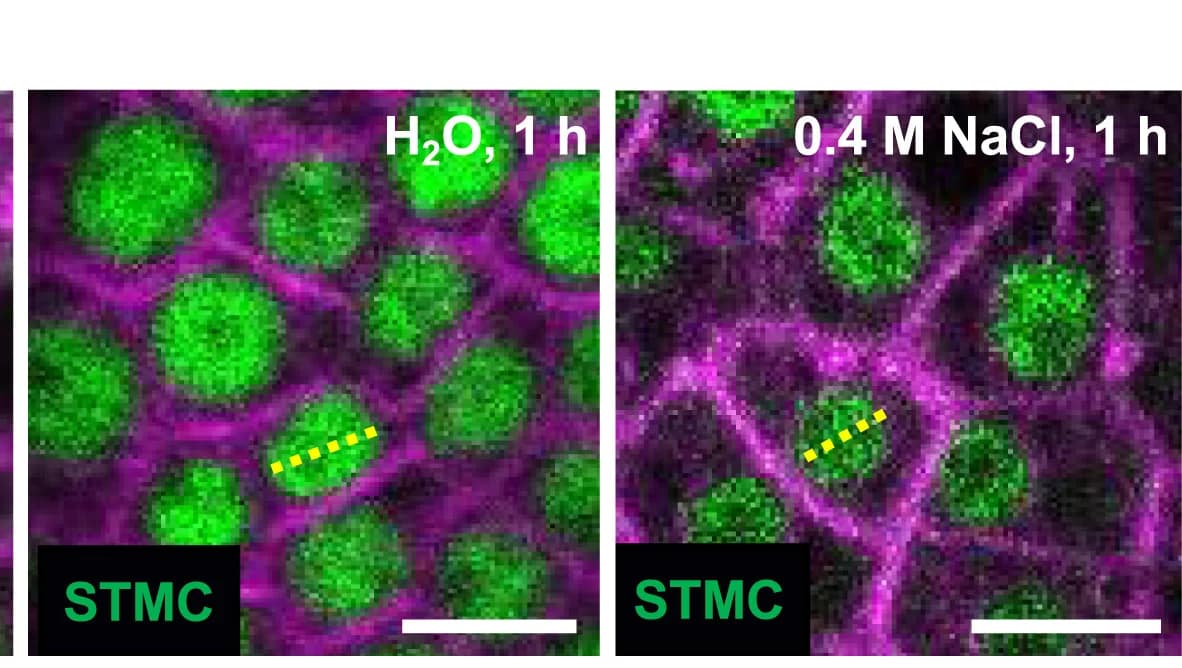 Open access visualization of Microscopy, STMC Fragment, Protein Condensation
