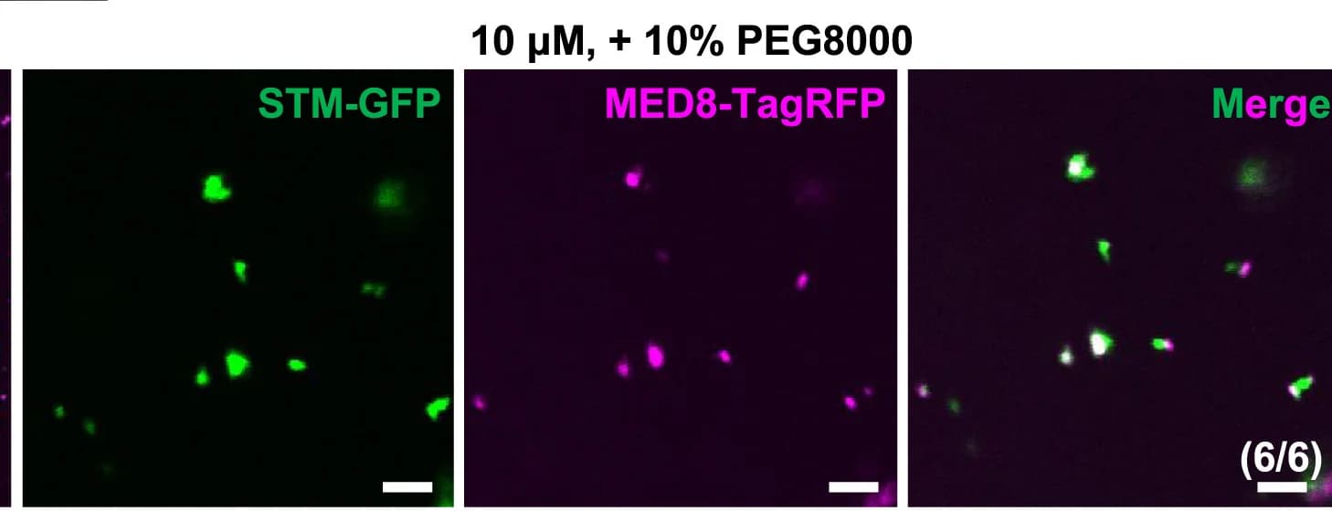 Open access visualization of Microscopy, In Vitro Phase Separation Assay, STM-GFP, MED8-TagRFP, Colocalization