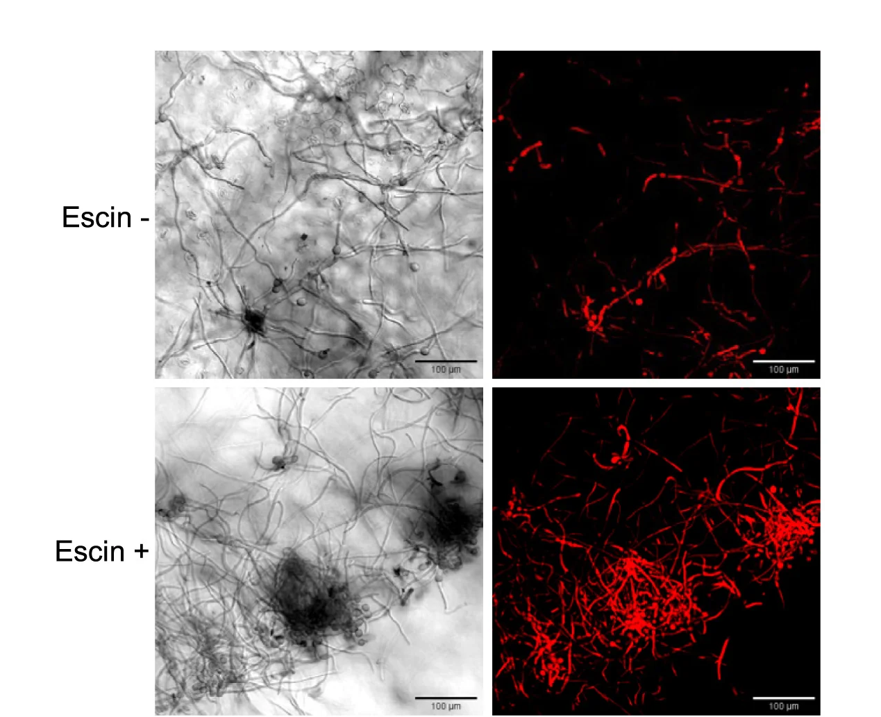 Open access visualization of Microscopy, Photo, Confocal Images, Arabidopsis Thaliana, Conidia