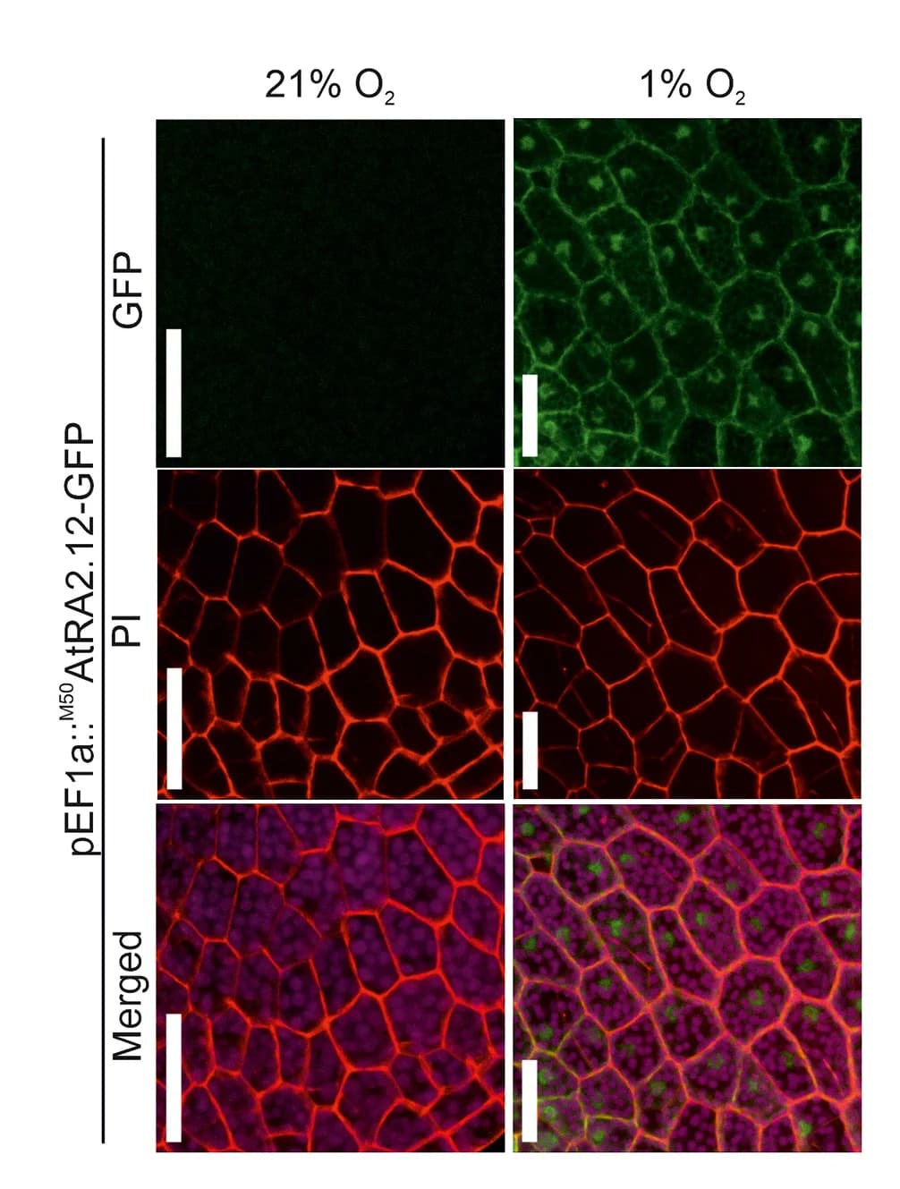 Open access visualization of Microscopy, Confocal Images, Subcellular Localization, AtRAP2.12-Citrine, M. polymorpha Gemmae