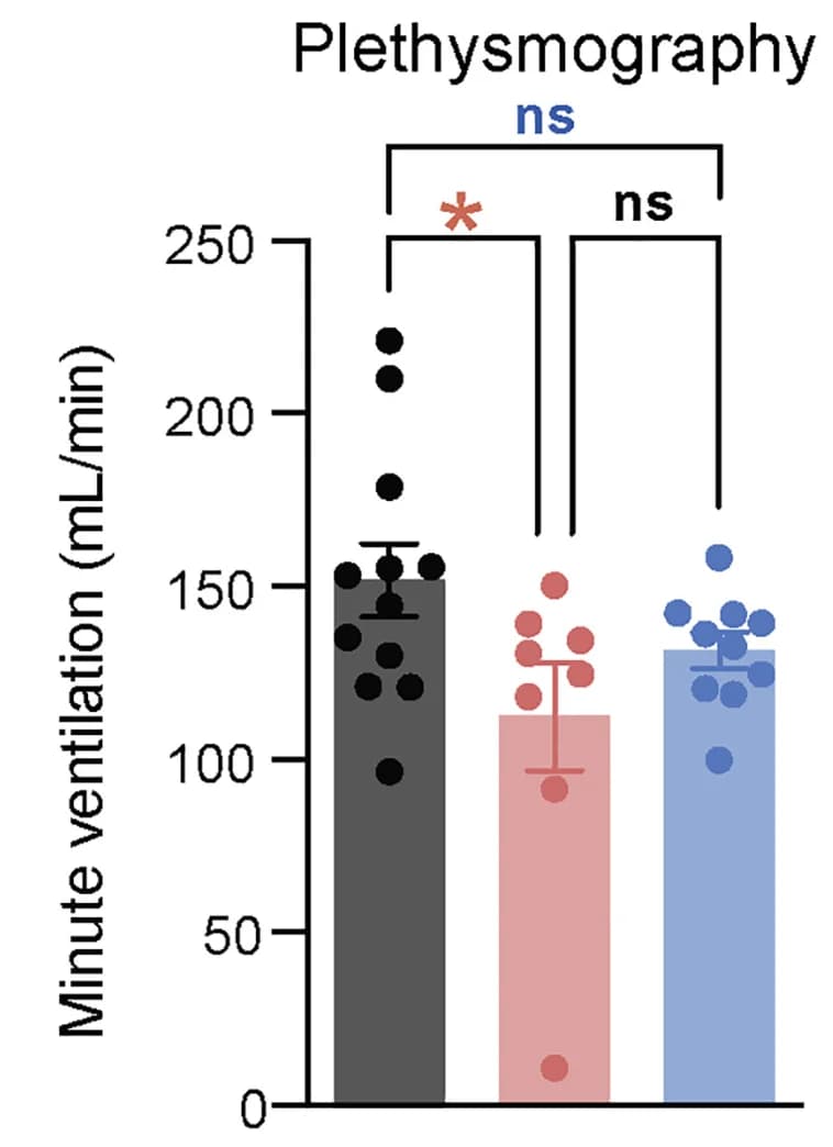 Open access visualization of Bar Plot, Error Bars, Scatter Plot, Minute Ventilation, Plethysmography