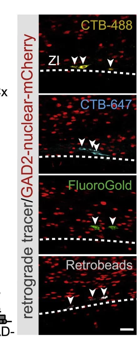 Open access visualization of Microscopy, ACx-Projecting Neurons, GABAergic Neurons, ZI Neurons