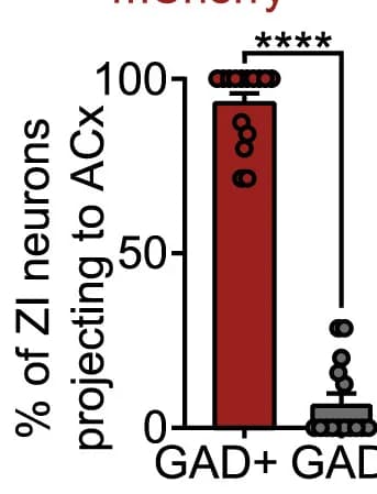 Open access visualization of Bar Plot, Scatter Plot, Error Bars, ACx-Projecting Neurons, ZI Neurons
