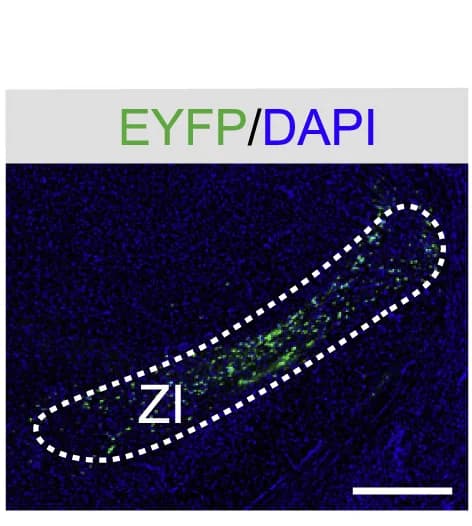 Open access visualization of Microscopy, Viral Expression, EYFP, GABAergic Neurons, ZI Neurons