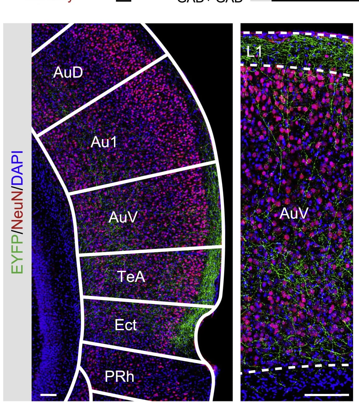 Open access visualization of Microscopy, ZI Axons, Density Gradient, L1, Secondary ACx